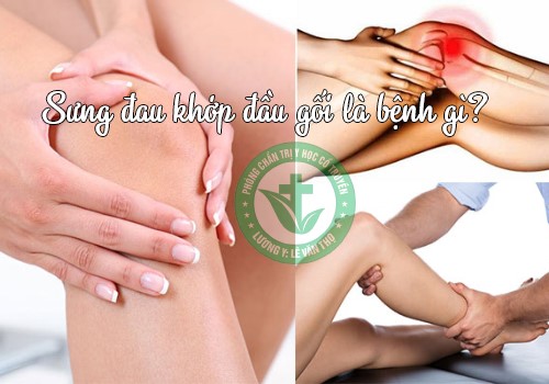 Địa Chỉ Trị Sưng Đau Khớp Đầu Gối Bằng Đông Y